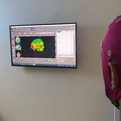 تحریک الکتریکی مغز TDCS و نقشه مغزی